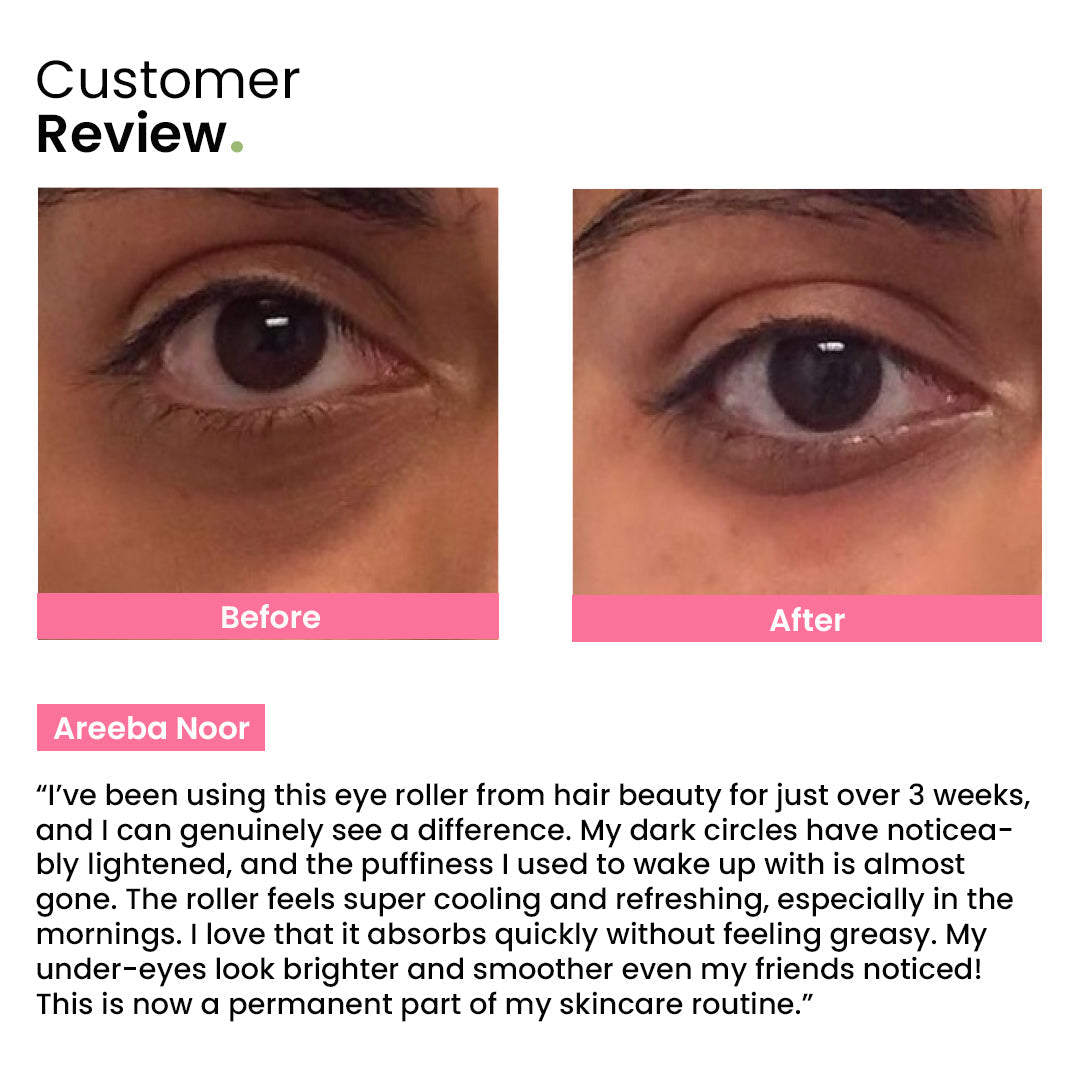Eye Roller | Visibly Reduces Dark Circles & Puffiness